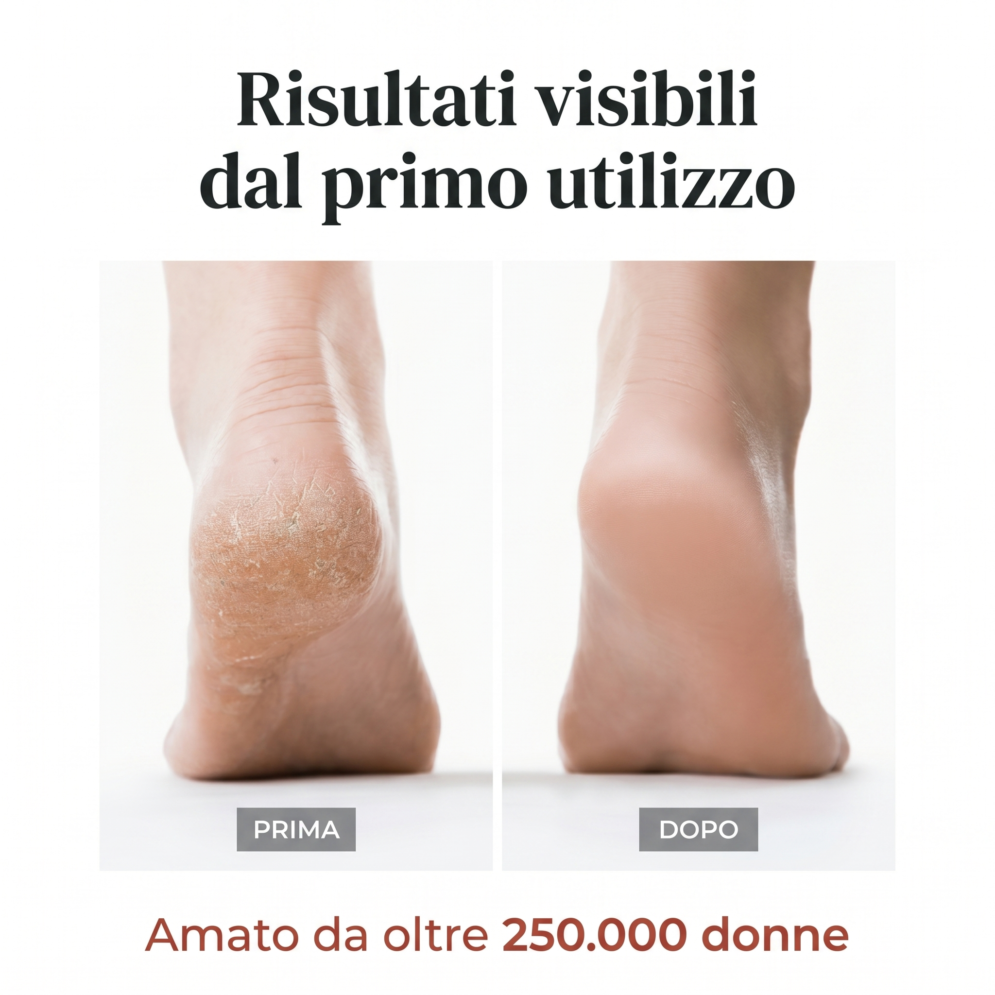 Sensia Velluto Pro
